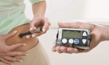 Açlık İnsülin Değerleri Kaç Olmalı? Açlık İnsülin Değerleri Kaç Olmalı?